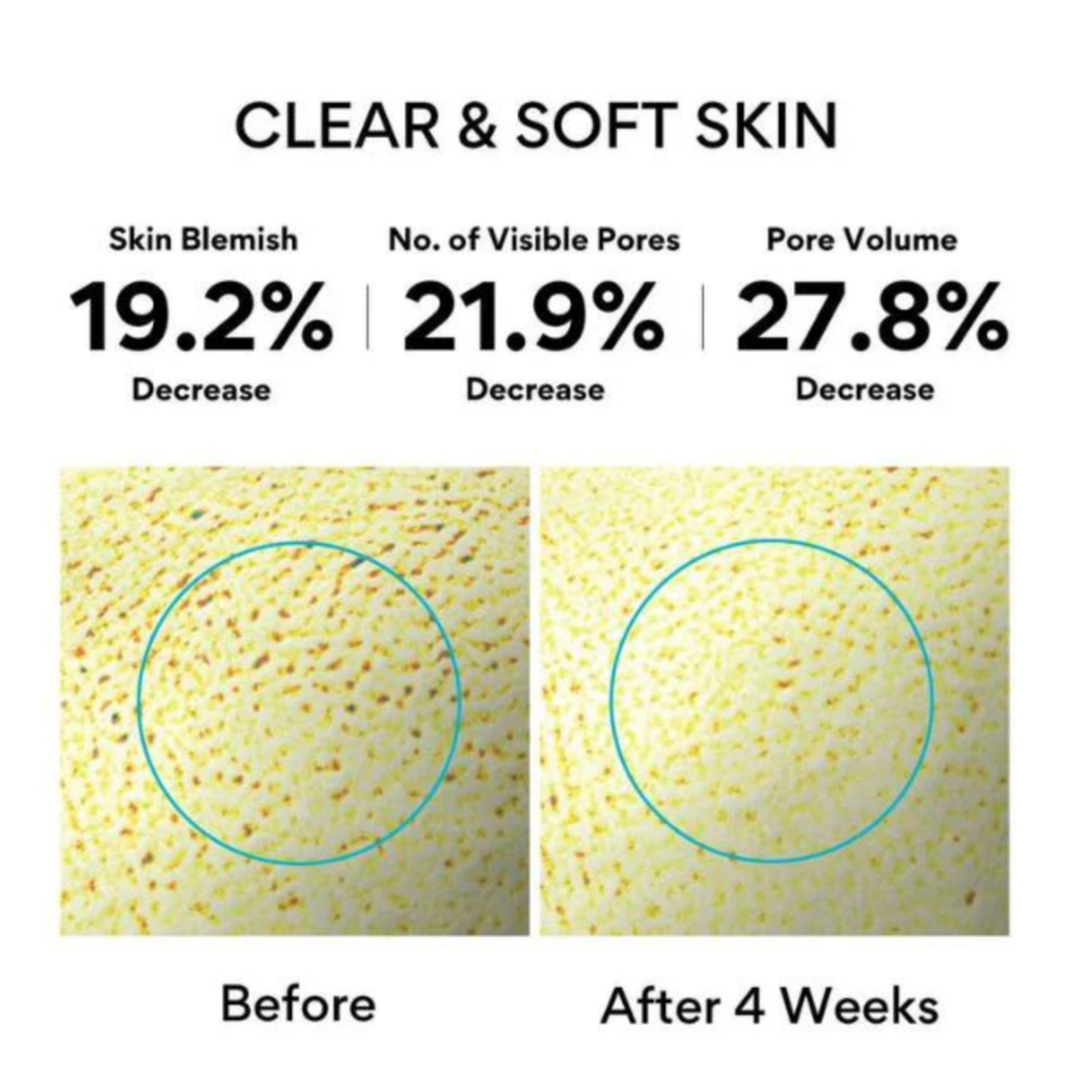 Retinol Cica Repair Ampoule | Gentle Retinol for Sensitive Skin (30ml)