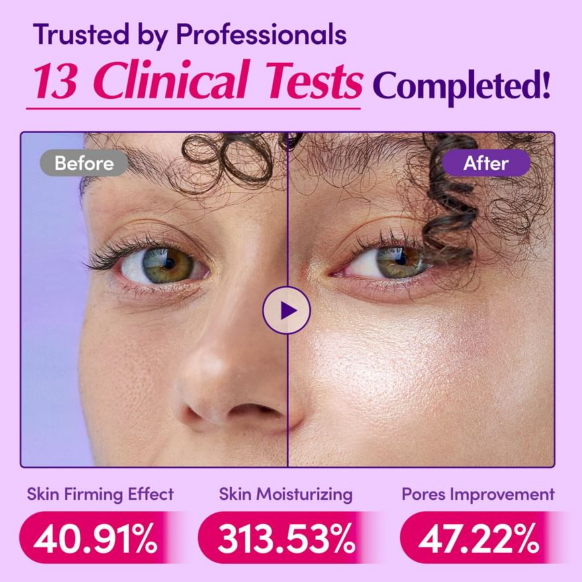 Before and after comparison of skin treatment with clinical test results on a purple background