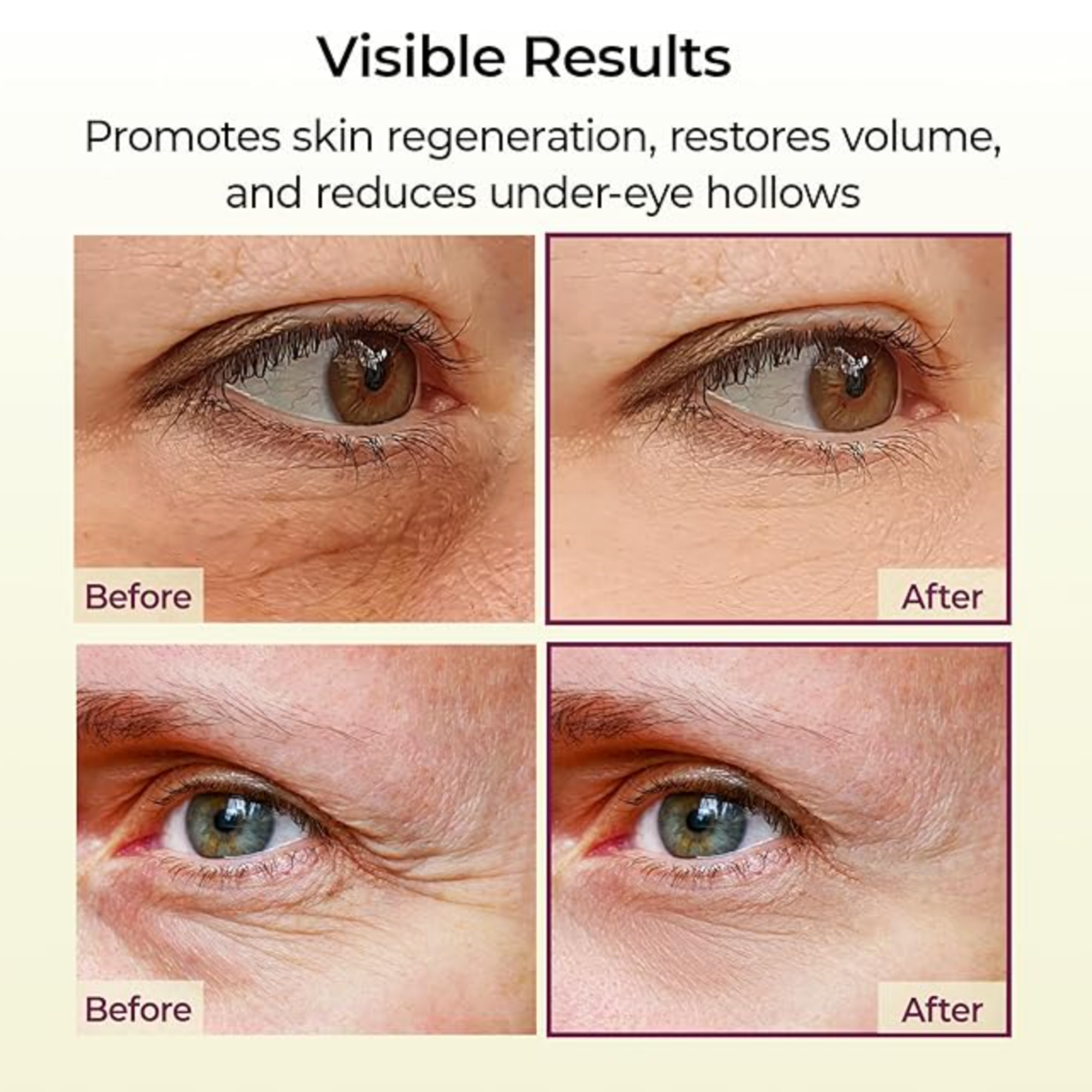 Cemenrete Calcium Volume Multi Balm 9g