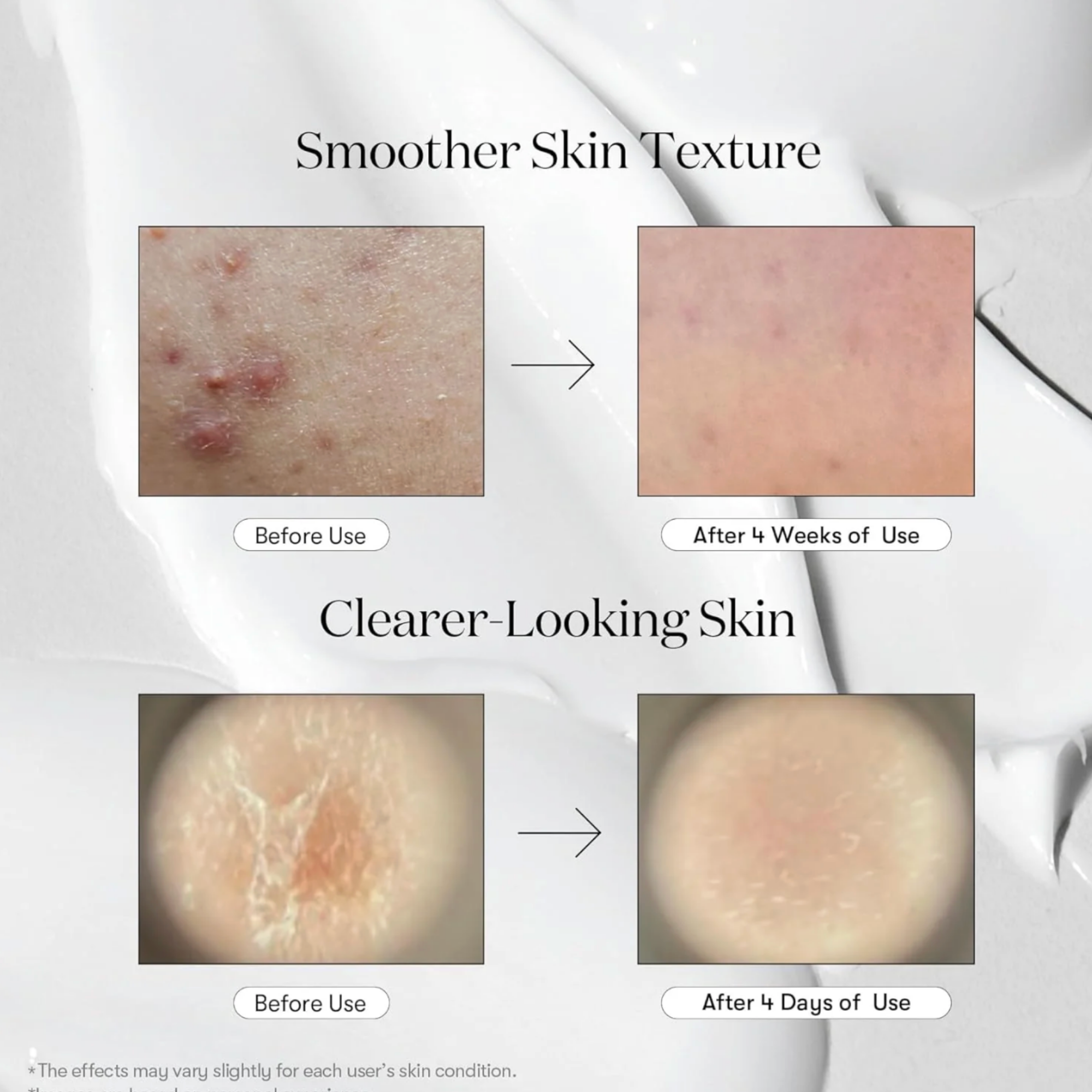 Reedle Shot 300 (50ml)