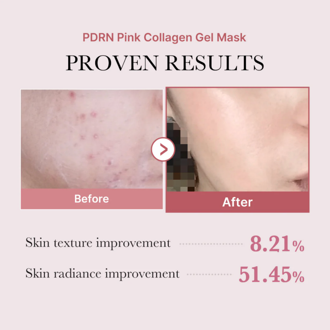 4x PDRN Pink Collagen Jelly Gel Mask