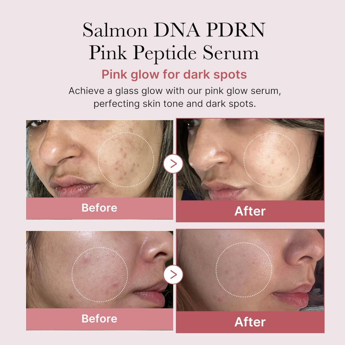 Collagen PDRN Pink Peptide Serum (30 ml)