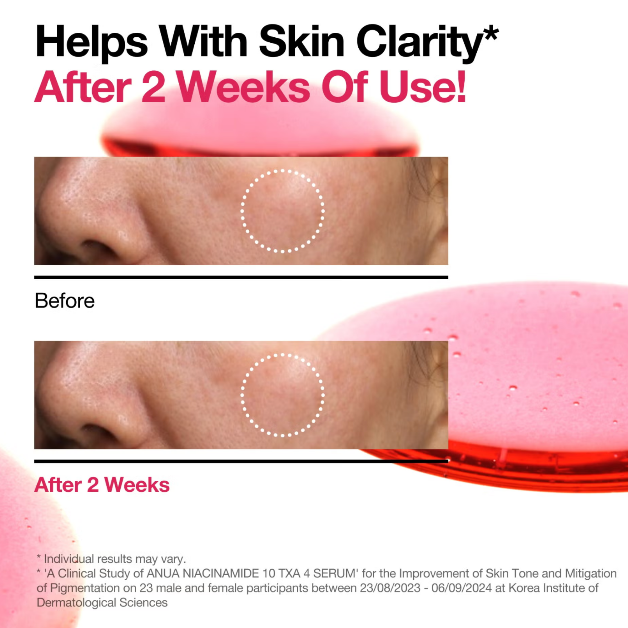 Niacinamide 10 + TXA 4 Serum (30 ml)