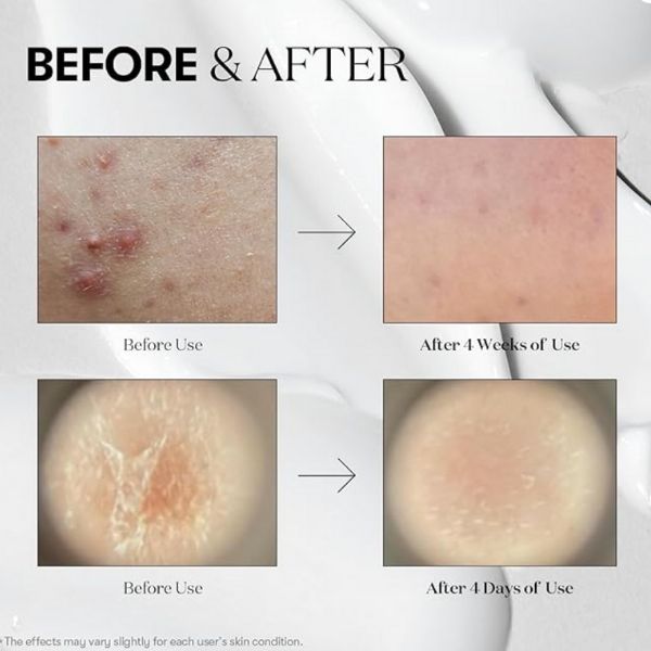 Reedle Shot 100 Microneedle Essence – 50 ml